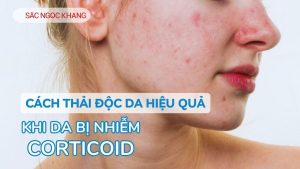Cách thải độc tố cho da mặt bị nhiễm corticoid
